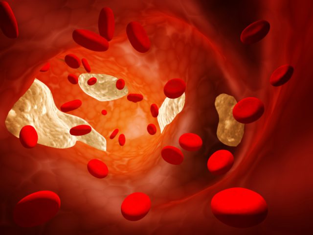 The Truth About Statins: Part 1