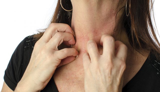 What Causes Contact Dermatitis?