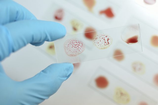 Blood types and Autoimmune Diseases